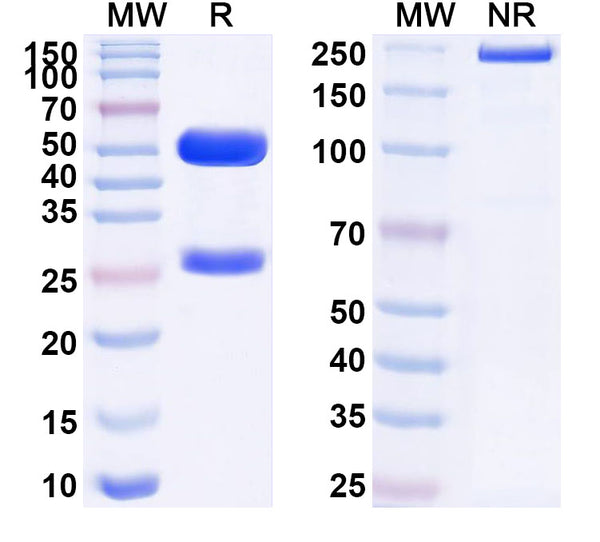 SDS-PAGE for Anti-Human CRH Antibody (SAA1561)