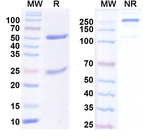 SDS-PAGE for InVivoMAb Anti-Human SAA1 Antibody (2A4).