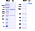 SDS-PAGE for InVivoMAb Anti-Human SAA1 Antibody (Iv0186).