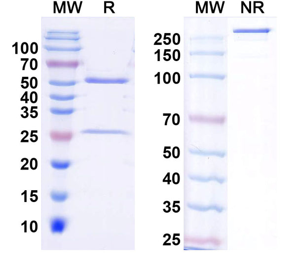 SDS-PAGE for InVivoMAb Anti-Human SAA1 Antibody (Iv0186).