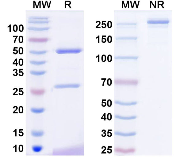 SDS-PAGE for Anti-Human SAA1 Monoclonal Antibody (1A081)