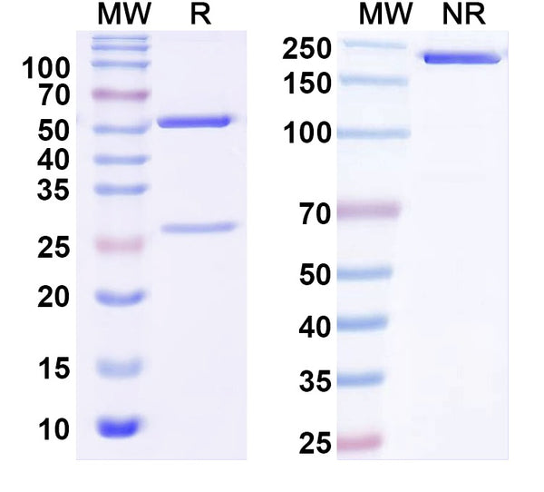 SDS-PAGE for Anti-Human SAA Monoclonal Antibody (1A319)