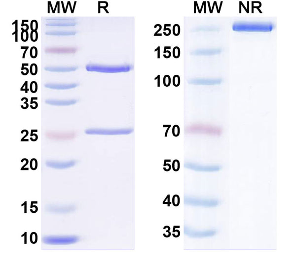 SDS-PAGE for Anti-Human SAA Monoclonal Antibody (1A320)
