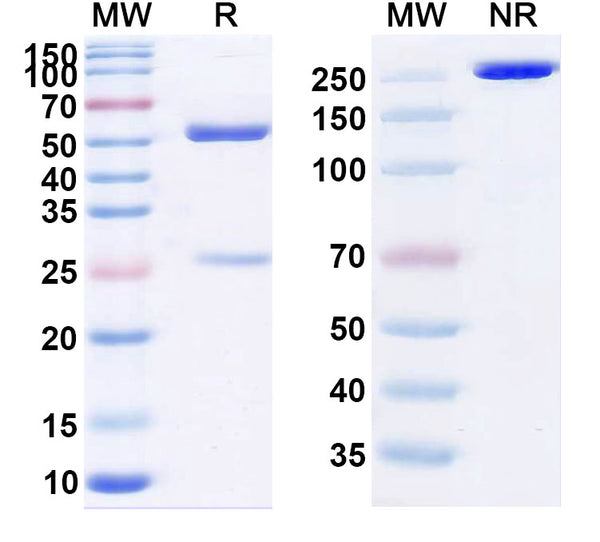 SDS-PAGE for Anti-Human SAA Monoclonal Antibody (1A322)