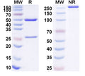 Anti-Human CD220/INSR Reference Antibody (IRAB-B) – Figure 1 of 2