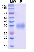 Recombinant Human CD2 Protein, C-His