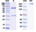 Anti-Human CD2 Reference Antibody (Siplizumab) – Figure 1 of 1