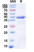 Recombinant Human COL6A2 Protein, N-His