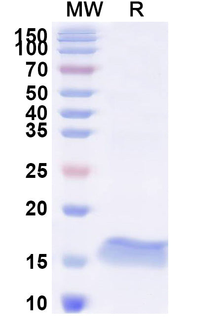 SDS-PAGE for Anti-Human BCL2 Nanobody (SAA1206)