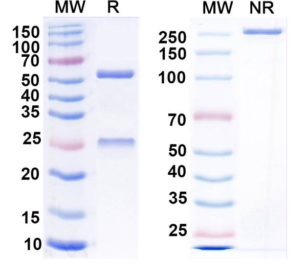 SDS-PAGE for Anti-CCK Antibody (L110/143)