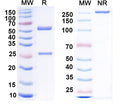 SDS-PAGE for Anti-CCK Antibody (L110/55)