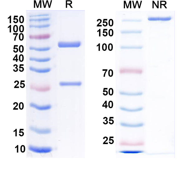 SDS-PAGE for Anti-CCK Antibody (L110/55)