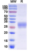 Recombinant Human CD32/FCGR2A Protein, C-His