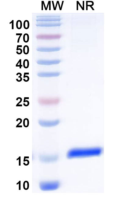SDS-PAGE for Anti-Human CD32/FcgR2 Nanobody (SAA2150)