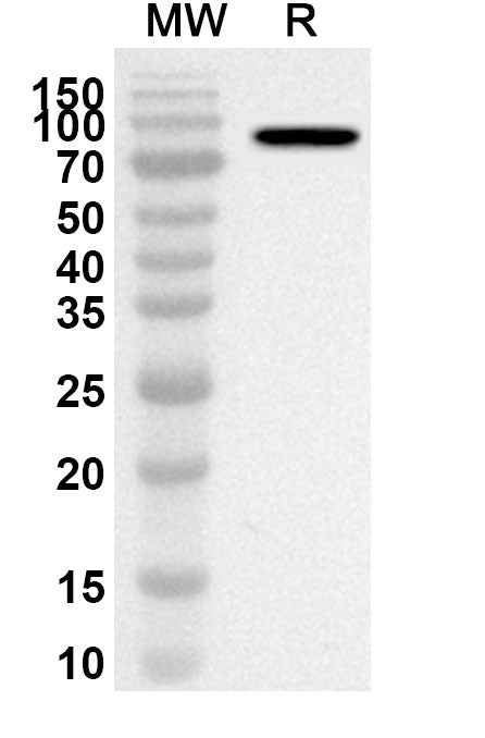 Western blot analysis was performed using anti-Human IFIT2 polyclonal antibody at 1ug/mL on recombinant Human IFIT2 (Catalog No. HY160012).