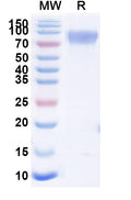 Recombinant Human CD117/KIT Protein, C-His
