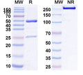 Anti-Human CD117/KIT Reference Antibody (LOP628) – Figure 1 of 1