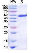 Recombinant Human DBT Protein, N-His-KSI