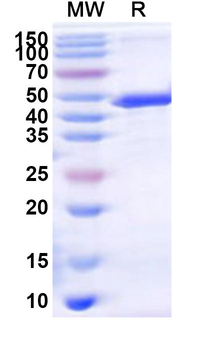 Recombinant Human DBT Protein, N-His-KSI