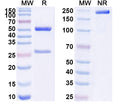 SDS-PAGE for Anti-Human C7 Antibody (SAA1569)