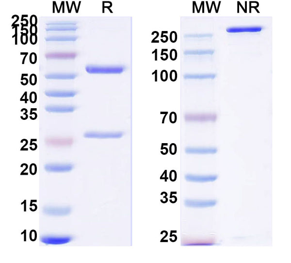 SDS-PAGE for Anti-Human Big Endothelin1/Big-ET-1 Antibody (SAA0803)