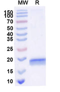 SDS-PAGE for Anti-Human SERPINE1/PAI-1 Nanobody (SAA1078)