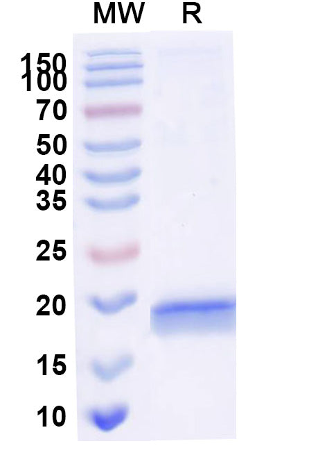 SDS-PAGE for Anti-Human SERPINE1/PAI-1 Nanobody (SAA1078)