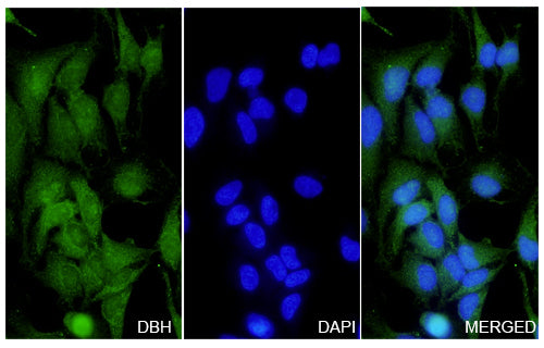 Hela cells were fixed with 4% paraformaldehyde for 20 minutes, followed by blocking with 5% goat serum for 1 hour. The cells were then incubated with a primary antibody targeting DBH (HY186014) at a concentration of 11.6 ug/ml overnight at 4°C. Afterward, the cells were incubated with a secondary antibody, Goat Anti-Rabbit IgG (Alexa Fluor-488) for 50 minutes at room temperature. The localization of DBH was visualized (shown in green), and nuclear DNA was stained with DAPI (shown in blue).