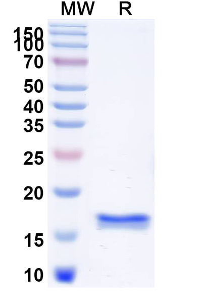 SDS-PAGE for Anti-Human CD45/PTPRC Nanobody (2H7)