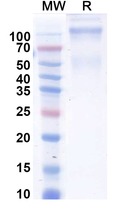 Recombinant Human MET/c-Met/HGFR Protein, C-His