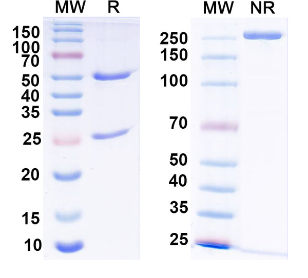 SDS-PAGE for Anti-Alpha-2A adrenergic receptor Antibody (N379/72)