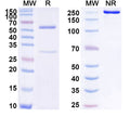 SDS-PAGE for Anti-Human ANXA1/Annexin A1 Antibody (SAA1753)