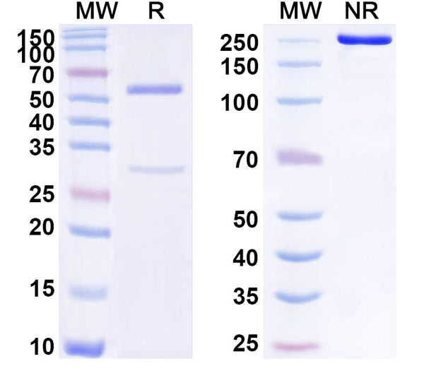 SDS-PAGE for Anti-Human ANXA1/Annexin A1 Antibody (SAA1753)