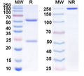 SDS-PAGE for Anti-Human IL5 Antibody (SAA0374)