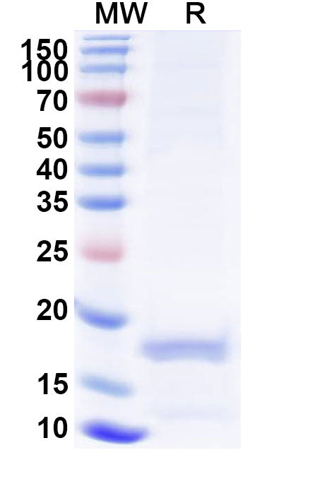 Recombinant Human APP Protein, N-His