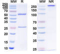 SDS-PAGE for Anti-Human APP/Amyloid beta Antibody (SAA1460).