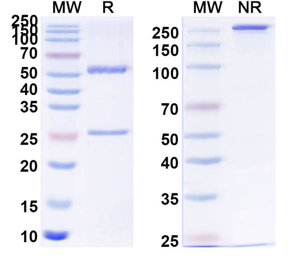 SDS-PAGE for Anti-Human APP/Amyloid beta Antibody (SAA1460).