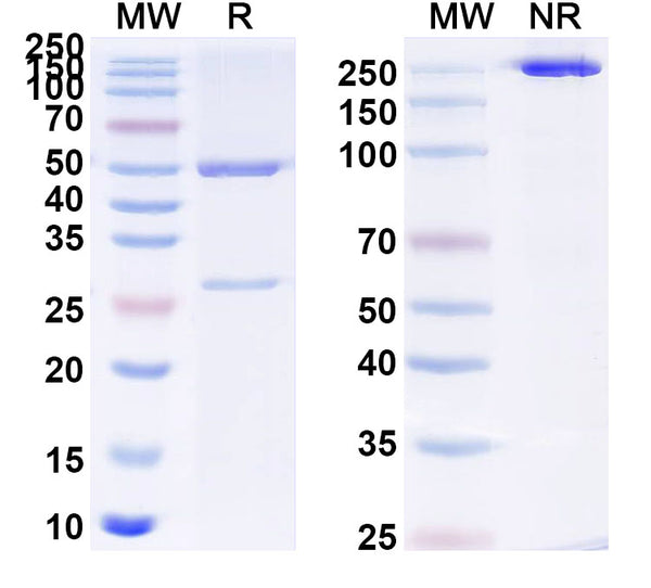 SDS-PAGE for Anti-Human APP/Amyloid beta Antibody (WO2).