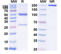 Anti-Human APP/Amyloid beta Reference Antibody (MEDI1814) – Figure 1 of 2