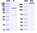 SDS-PAGE for Anti-Human CD179a/VPREB1 Antibody (SAA1738)