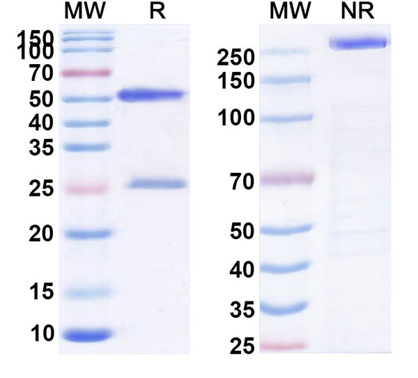 SDS-PAGE for Anti-Human Calprotectin (S100A8/S100A9) Monoclonal Antibody (1A317)