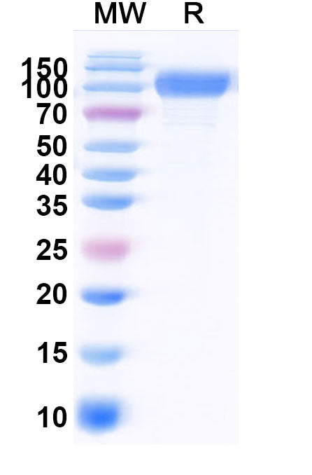 Recombinant Human CD29/ITGB1 Protein, C-His