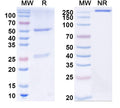 SDS-PAGE for Anti-Human free PSA/fPSA Monoclonal Antibody (1A276)