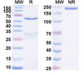 SDS-PAGE for Anti-Human free PSA/fPSA Monoclonal Antibody (1A277)