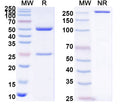 SEC-HPLC detection for Anti-Human VWF Antibody (ABS0287).