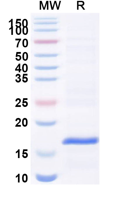SDS-PAGE for Anti-Human vWF Nanobody (C37)