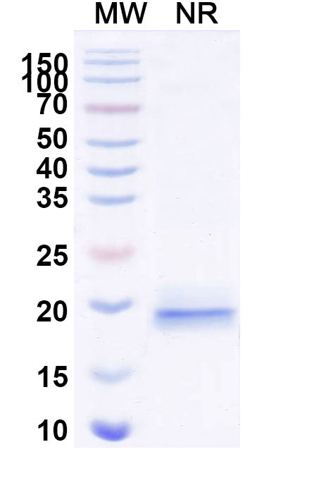 SDS-PAGE for Anti-Human Intact VWF Nanobody (KB-VWF-D3.1).