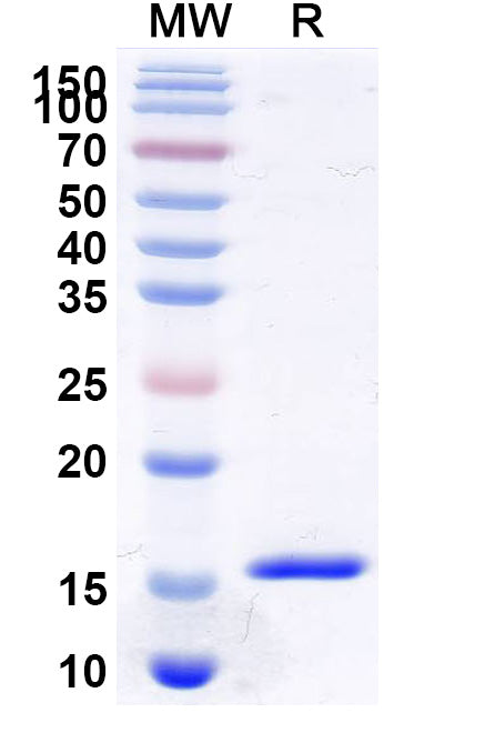 SDS-PAGE for Anti-Human VWF Nanobody (KB-VWF-006)