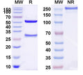 SDS-PAGE for Anti-Human VWF Antibody (NMC-4)