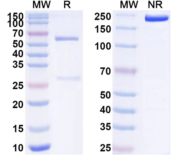 SDS-PAGE for Anti-Human S100B Antibody (SAA1555)